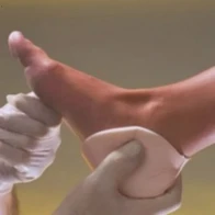 Allevyn large heel coque talon x10